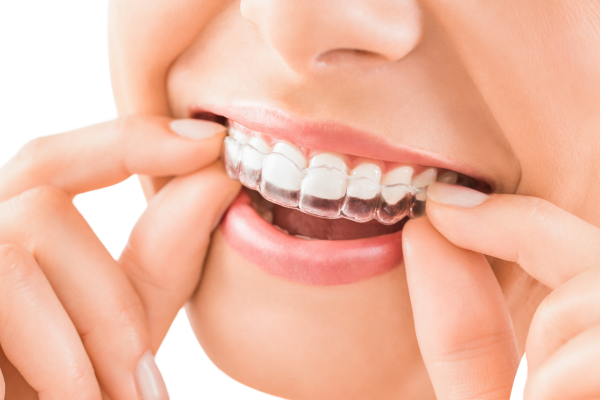 Invisalign and Orthodontic Care